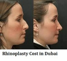 rhinoplasty expert nyc